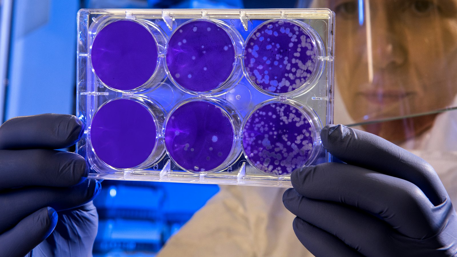 A researcher holds up a cell-culture plate