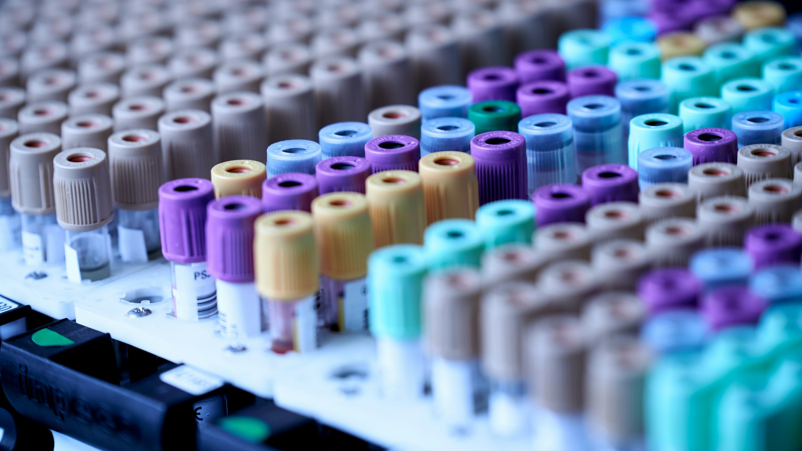 Rows of blood sample tubes in a laboratory rack